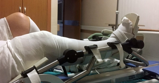 Person with a leg injury at a California hospital.